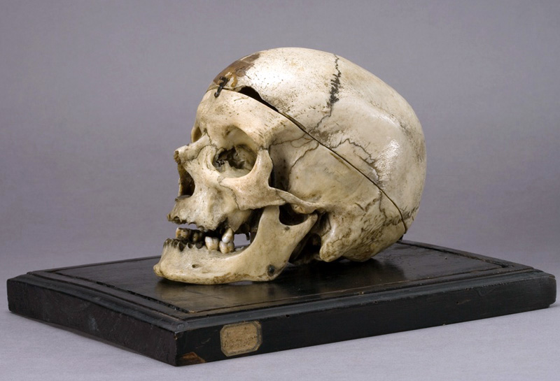 Cranio-Villella1-300x204.jpg